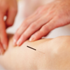 Logan College of Chiropractic Acupuncture