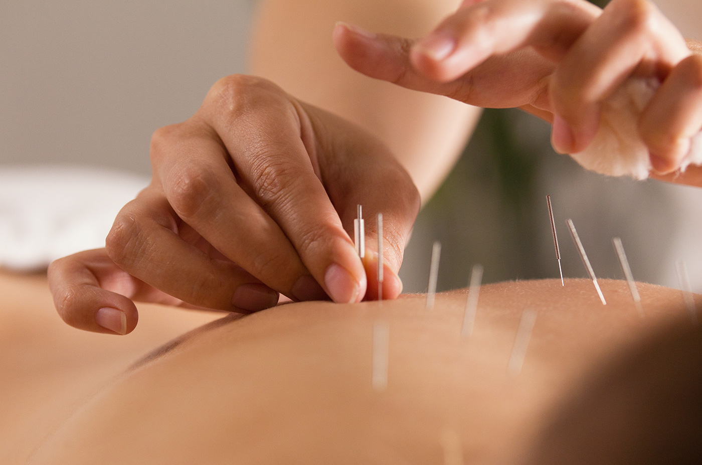 acupuncture-grid